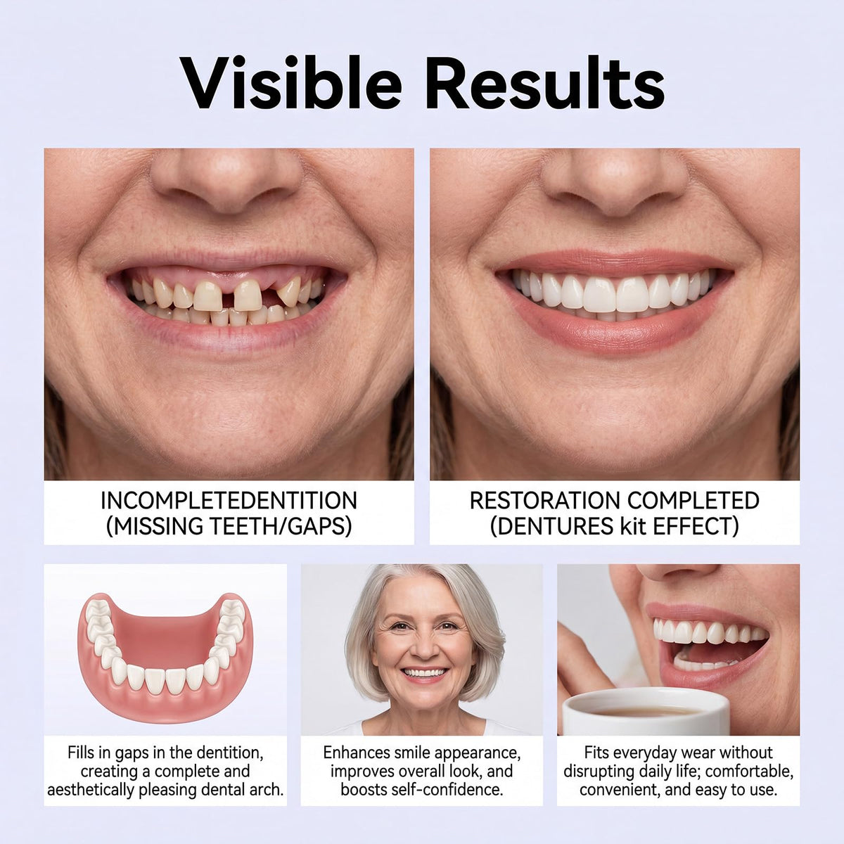 Heat Moldable Silicone Denture Kit R833023